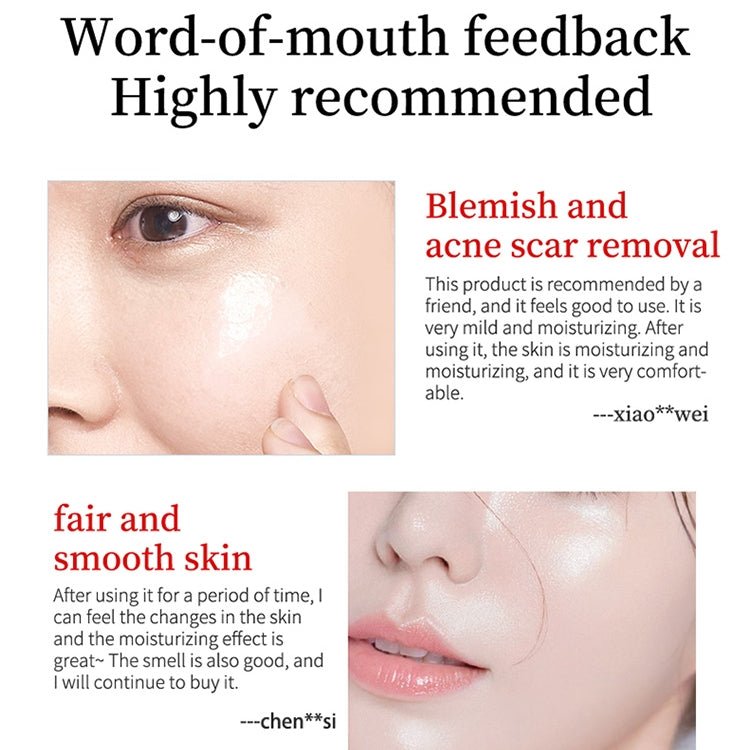 YOUBUY Whitening Blemish Cream Buy 1 Get 1 Free - Beasymart