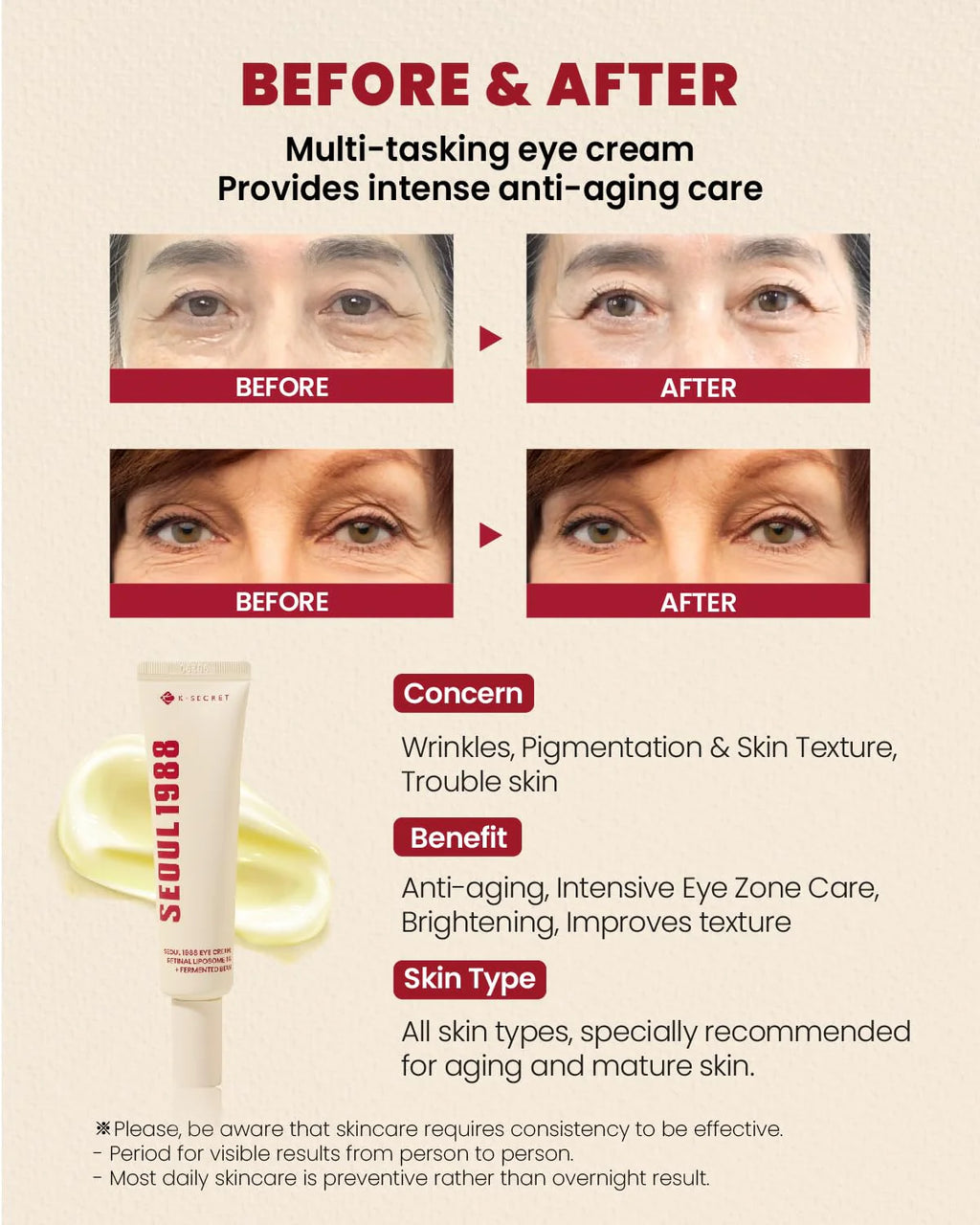 K-Secret Seoul 1988 Eye Cream : Retinal Liposome 4% + Fermented Bean – 30ml