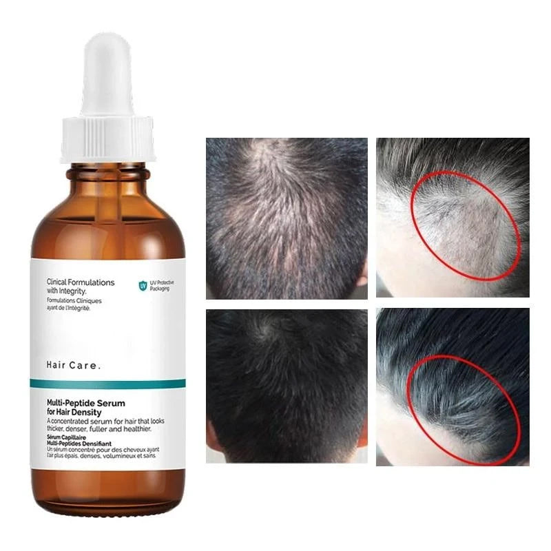 Multi-Peptide Serum for Hair Density – 60ml Hair Growth and Strengthening Treatment