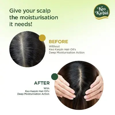 Keo Karpin Light Hair Oil With Olive Oil & Vitamin E Deep Scalp Nourishment Non Sticky Hair Oil 300ml Made In India