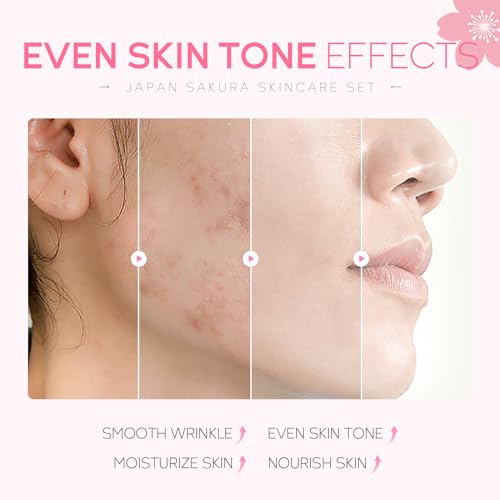 LAIKOU Japan Sakura Serum 17ml – Shrink Pores, Remove acne, Skin rejuvenation Japan Extract - Beasymart